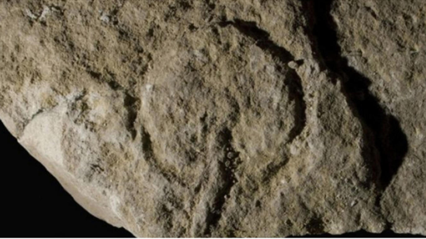 Vulva EarlyMan